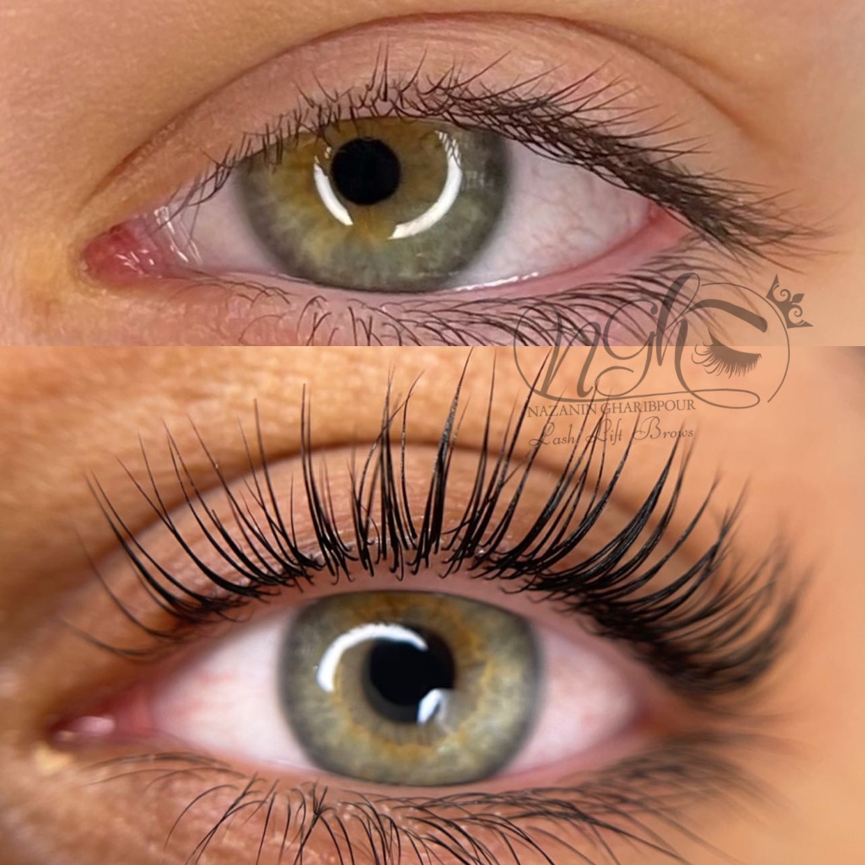 لیفت و لمینیت و بوتاکس مژه